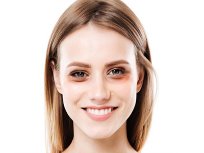 کمبود چه ویتامینی در بدن،باعث سیاهی دور چشم میشود؟