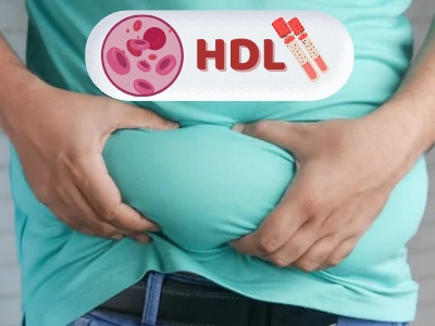 چه علائمی نشان دهنده چربی خون بالا است؟